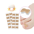 Corretor de unhas encravadas