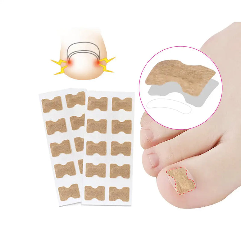 Corretor de unhas encravadas