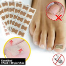 Corretor de unhas encravadas