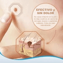 Creme WART CARE™ - Removedor de Verrugas 