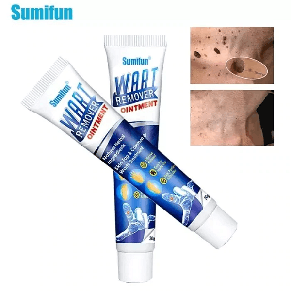 Creme WART CARE™ - Removedor de Verrugas 