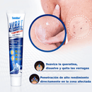 Creme WART CARE™ - Removedor de Verrugas 