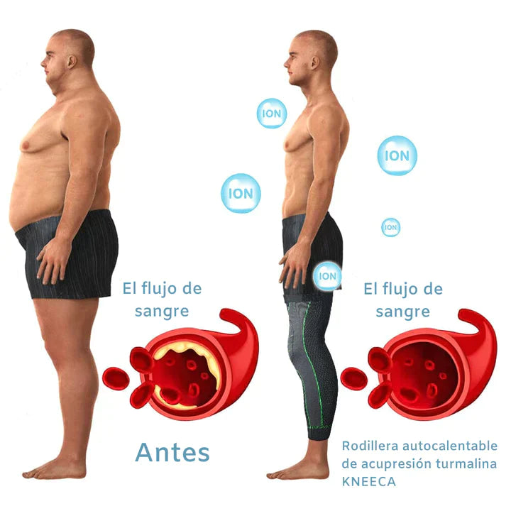 RodiCupression™ - Joelheira de acupressão com turmalina autoaquecida 