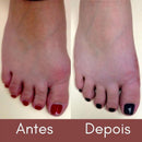 Bunion Top™ - 50% DE DESCONTO 🔥 - Corretor Ortopédico de Joanete (1 Par)