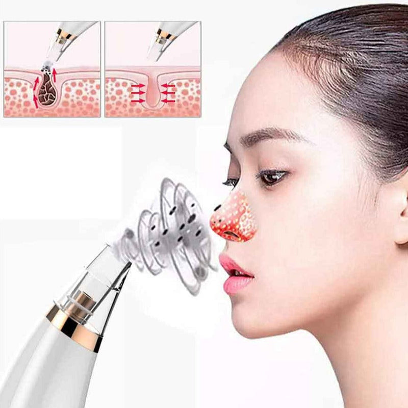 Limpador Facial Portátil - SoftSkin™